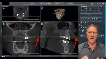 Tip of the Day: Endo Layout